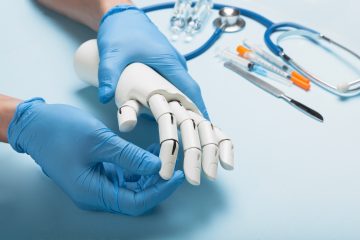 Prosthetics hands at doctor in clinic. Artificial limb