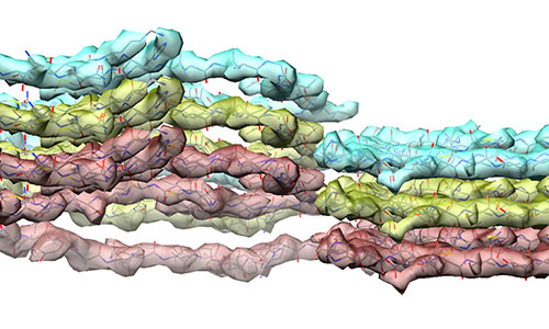 Blue, green and red bands show how the corrupted proteins are stacked upon each other