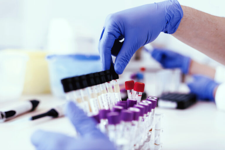 Photo of a gloved hand putting a research vial into a rack alongside others