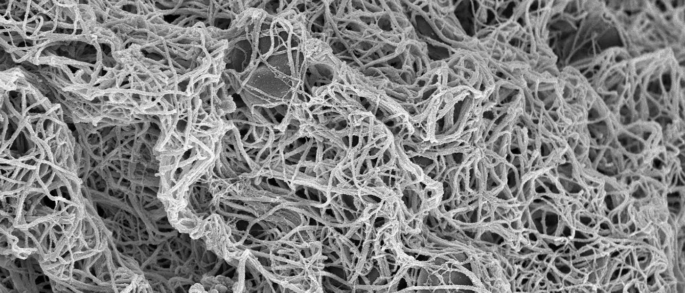 Scanning Electron Microscopy (SEM) image of a blood clot and a mesh substance called fibrin