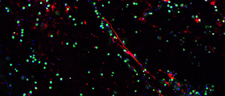 Image shows red fluorescent nanoparticles binding to activated neutrophils
