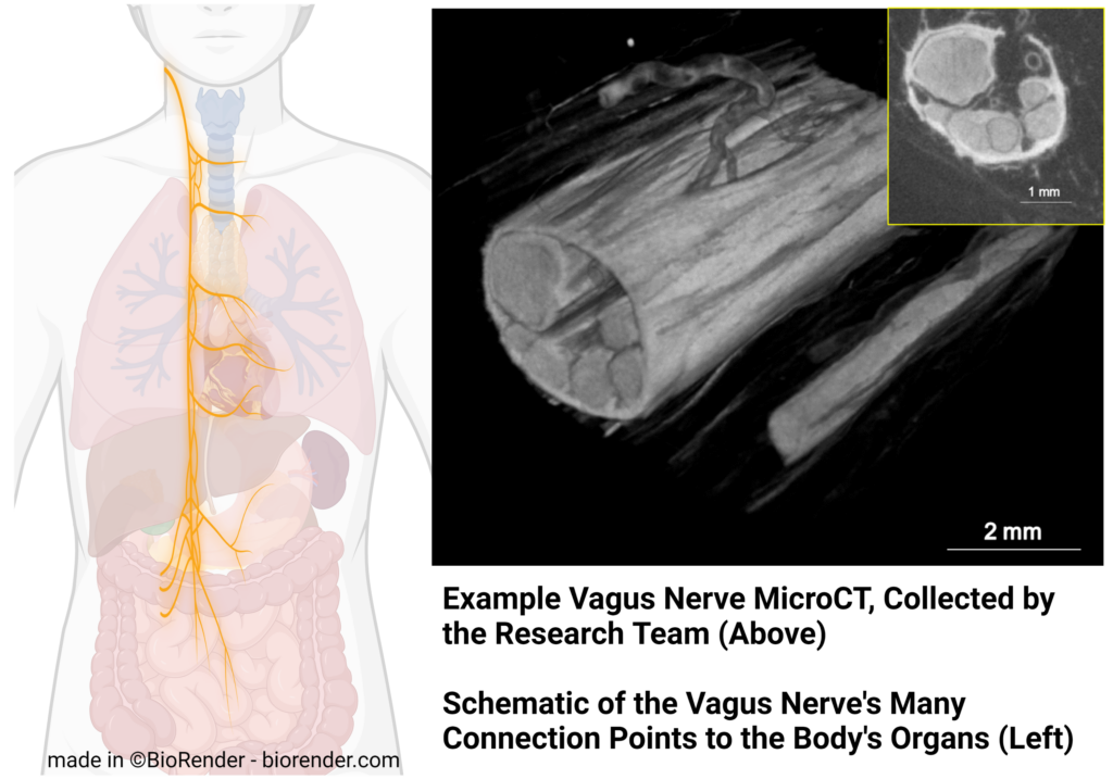 Image of the body's vagus nerve.
