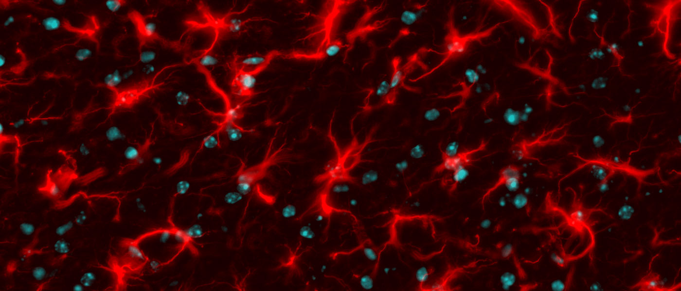 Photo of astrocytes in vivo
