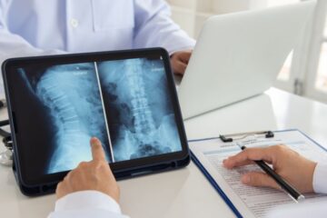 lumbar vertebrae x-ray image by mri on digital tablet screen with medical team for consult. Courtesy of Getty Images.