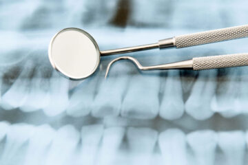 Photo of dental x-rays and dental tools
