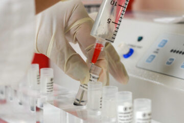 Close up photo of a doctor drawing up mesenchymal stem cells from vials on counter into syringe