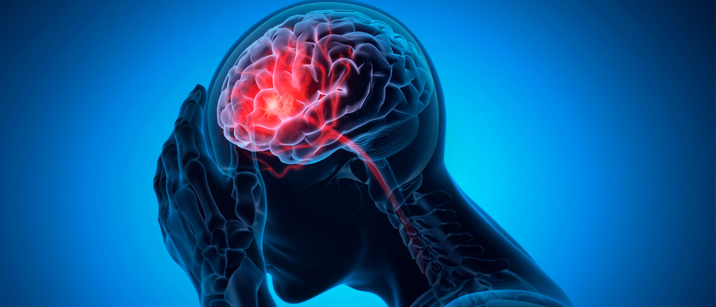 Photo illustration of a human figure with a hand on their head and the brain highlighted in red to signify pain