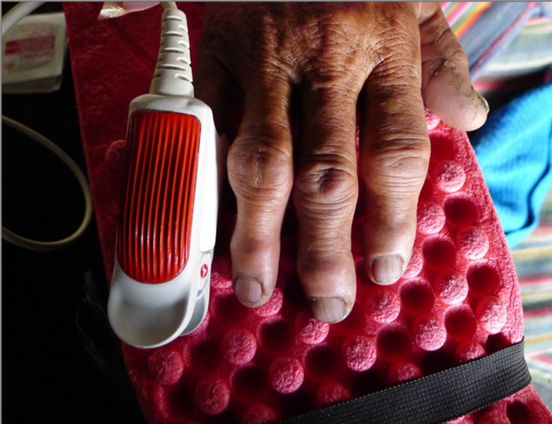 Photo of a Tibetan woman's hand next to an blood-oxygen monitor device