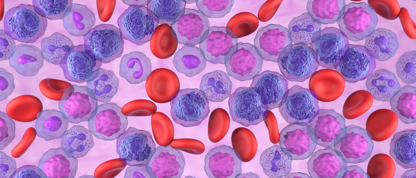 Microscopic view 3d illustration of acute myeloid leukemia (AML) cells in blood flow