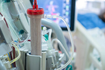 Close up photo of a patient's dialysis with a critically ill patient in a bed in the background