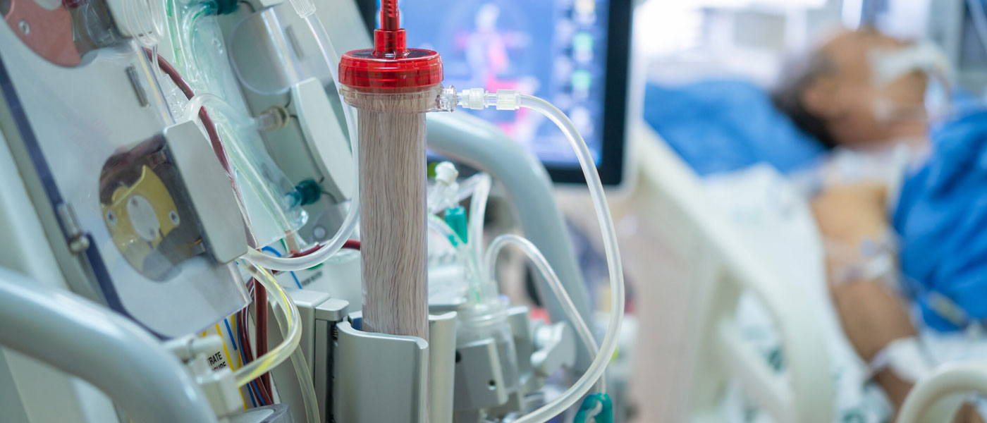 Close up photo of a patient's dialysis with a critically ill patient in a bed in the background