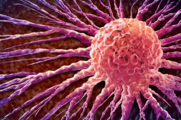 Photo illustration of a breast cancer cell