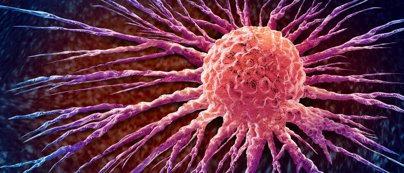 Photo illustration of a breast cancer cell